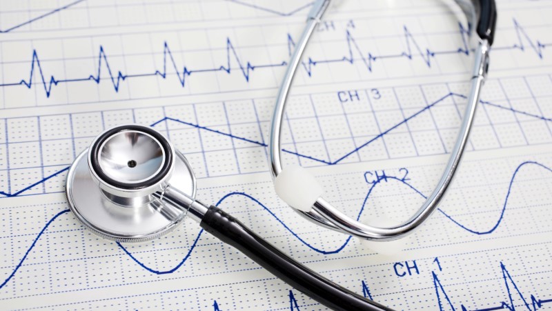 ekg vizsgágat eredménye Kardiologia - egy sztetoszkóp az EKG nomtatáson