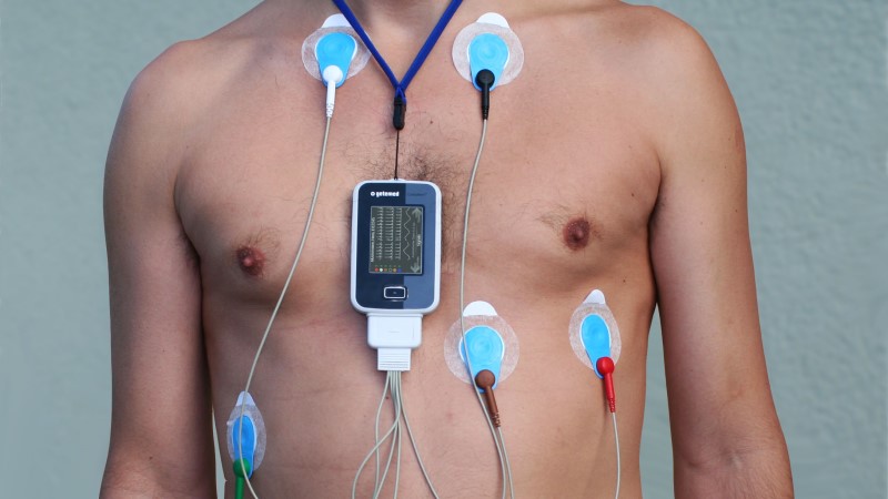 nyugalmi EKG Kardiologia - felhelyezett EKG készülék nyugalmi vizsgálat közben